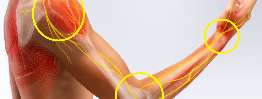 upper_extremity_pain1084x412